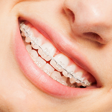 Orthodontic Services